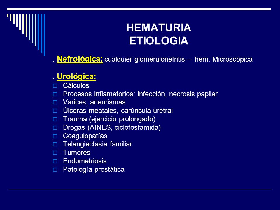 HEMATURIA ETIOLOGIA . Nefrológica: cualquier glomerulonefritis--- hem. Microscópica. . Urológica: Cálculos.