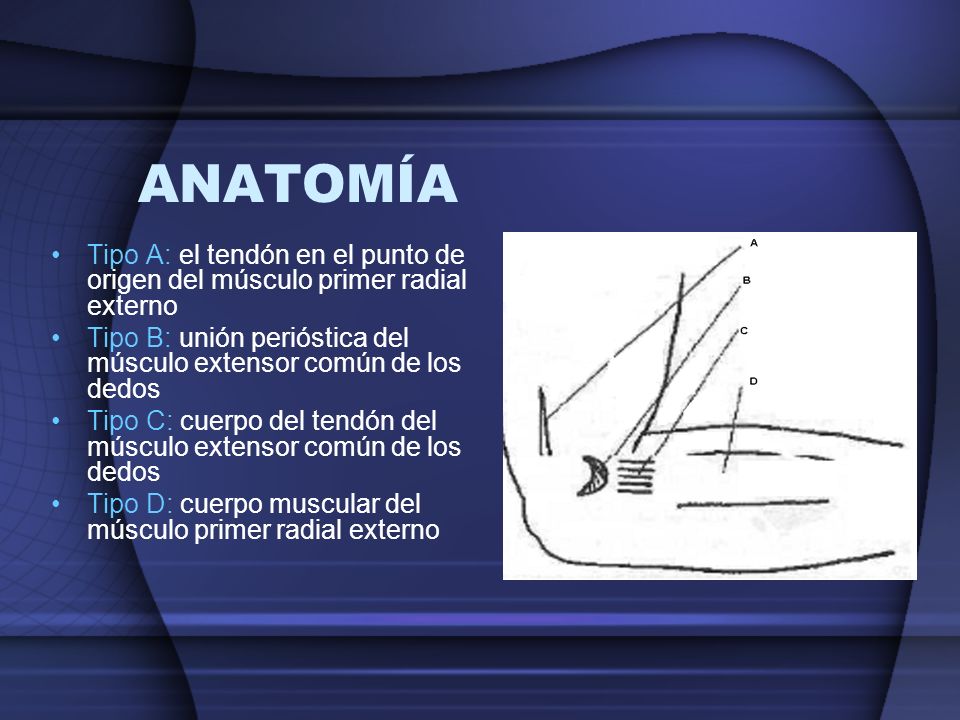 ANATOMÍA Tipo A: el tendón en el punto de origen del músculo primer radial externo. Tipo B: unión perióstica del músculo extensor común de los dedos.