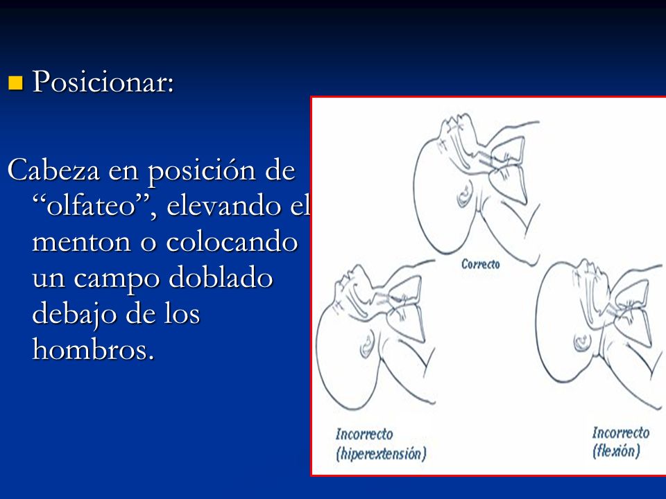 Posicionar: Cabeza en posición de olfateo , elevando el menton o colocando un campo doblado debajo de los hombros.