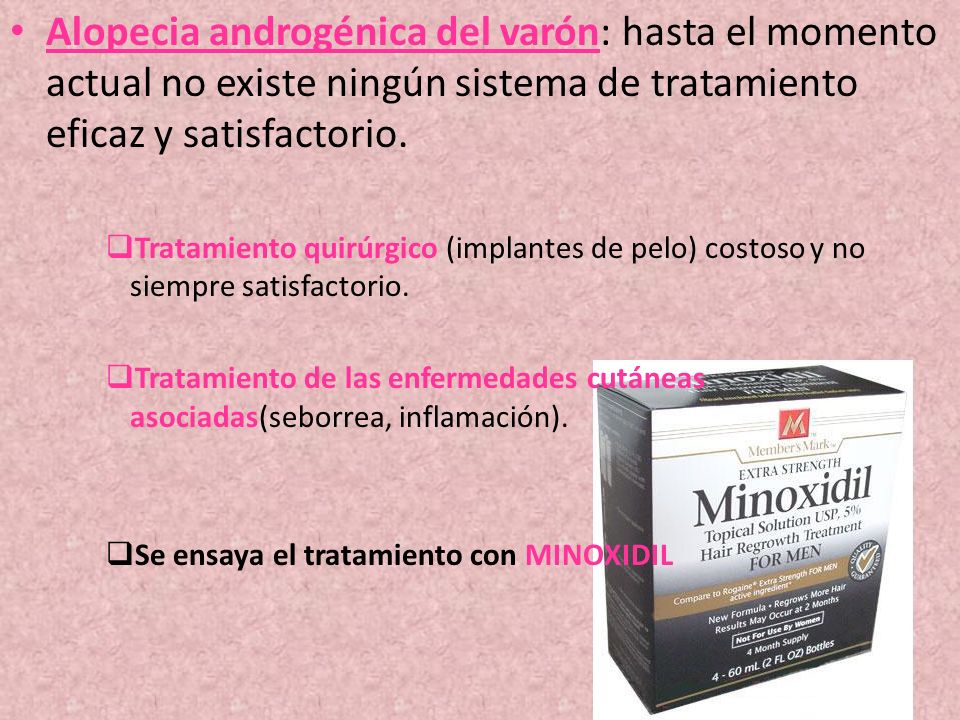 Alopecia androgénica del varón: hasta el momento actual no existe ningún sistema de tratamiento eficaz y satisfactorio.