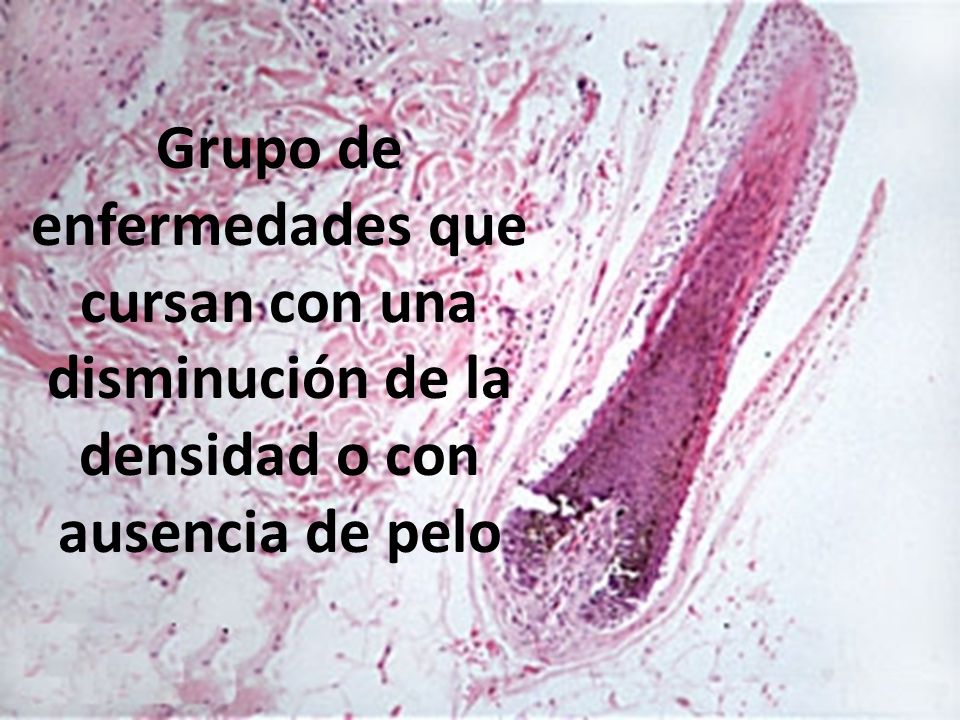 Grupo de enfermedades que cursan con una disminución de la densidad o con ausencia de pelo