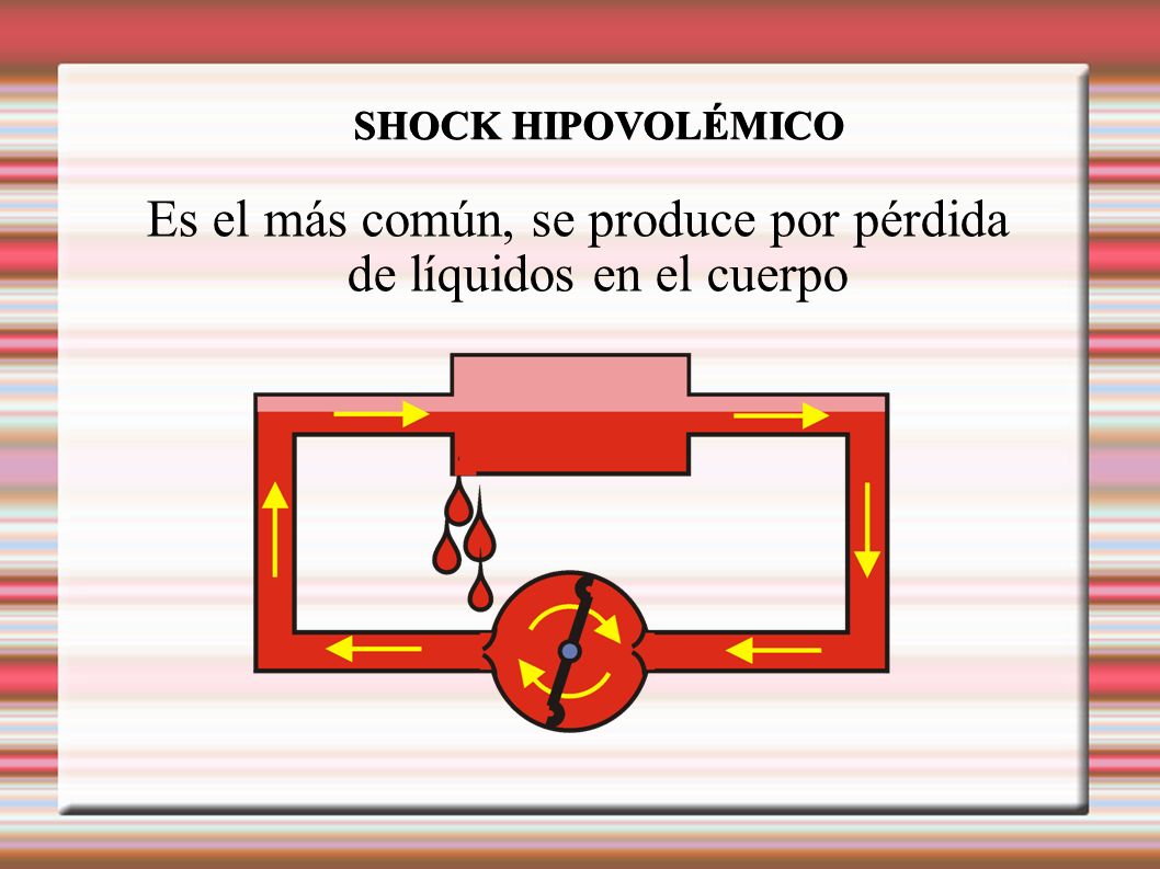 Es el más común, se produce por pérdida de líquidos en el cuerpo