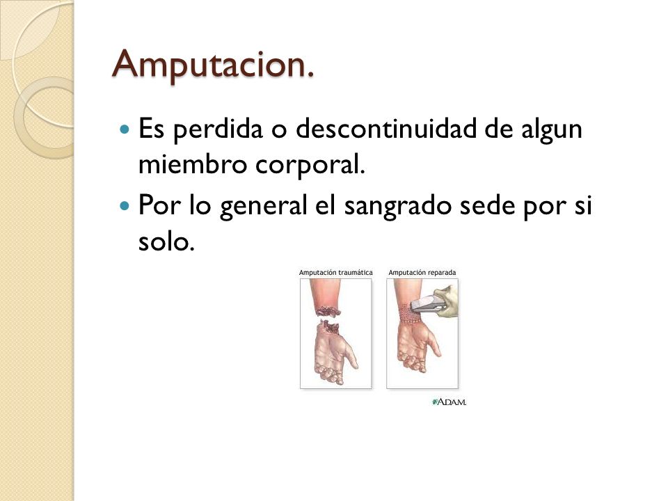 Amputacion. Es perdida o descontinuidad de algun miembro corporal.