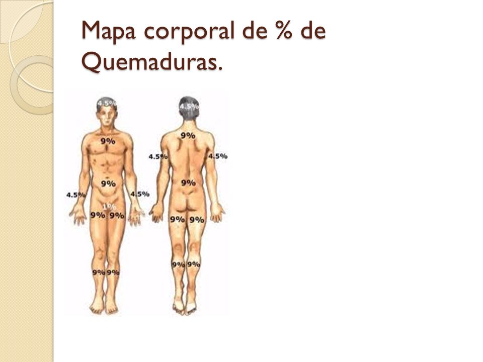 Mapa corporal de % de Quemaduras.