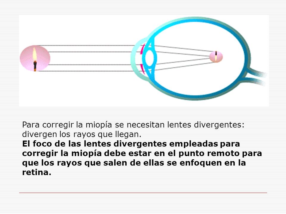 Para corregir la miopía se necesitan lentes divergentes: divergen los rayos que llegan.
