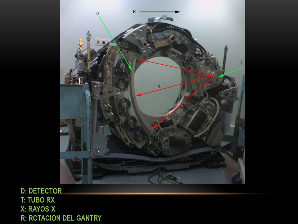D: DETECTOR T: TUBO RX X: RAYOS X R: ROTACION DEL GANTRY