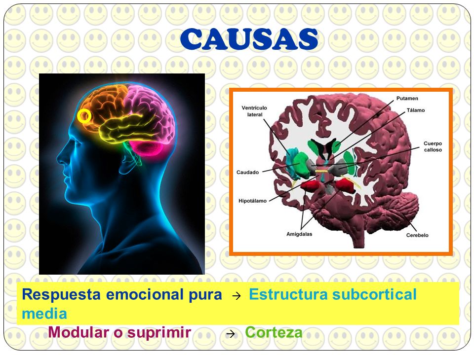 CAUSAS Respuesta emocional pura  Estructura subcortical media