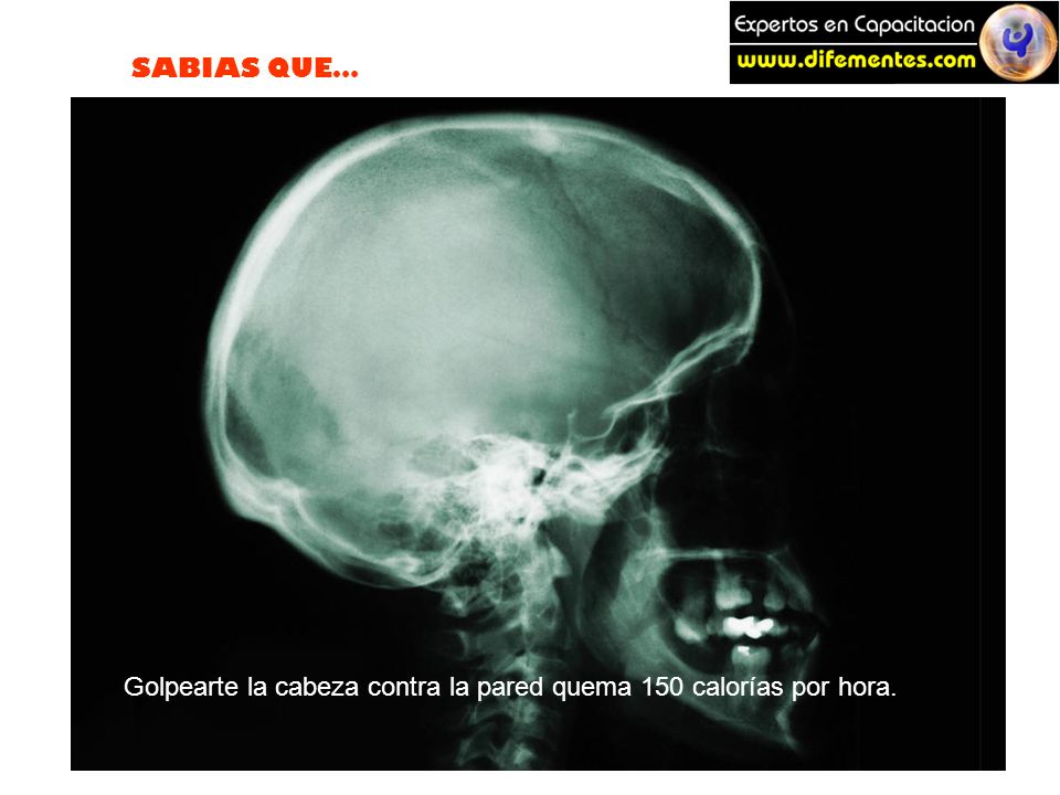Golpearte la cabeza contra la pared quema 150 calorías por hora.