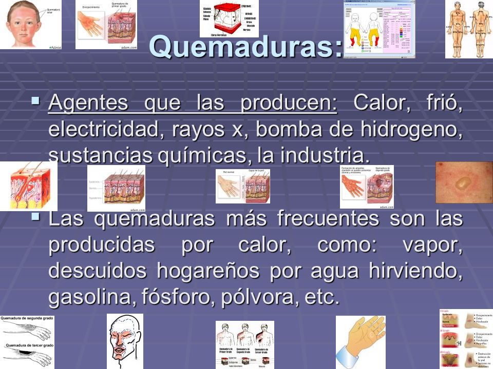 Quemaduras: Agentes que las producen: Calor, frió, electricidad, rayos x, bomba de hidrogeno, sustancias químicas, la industria.