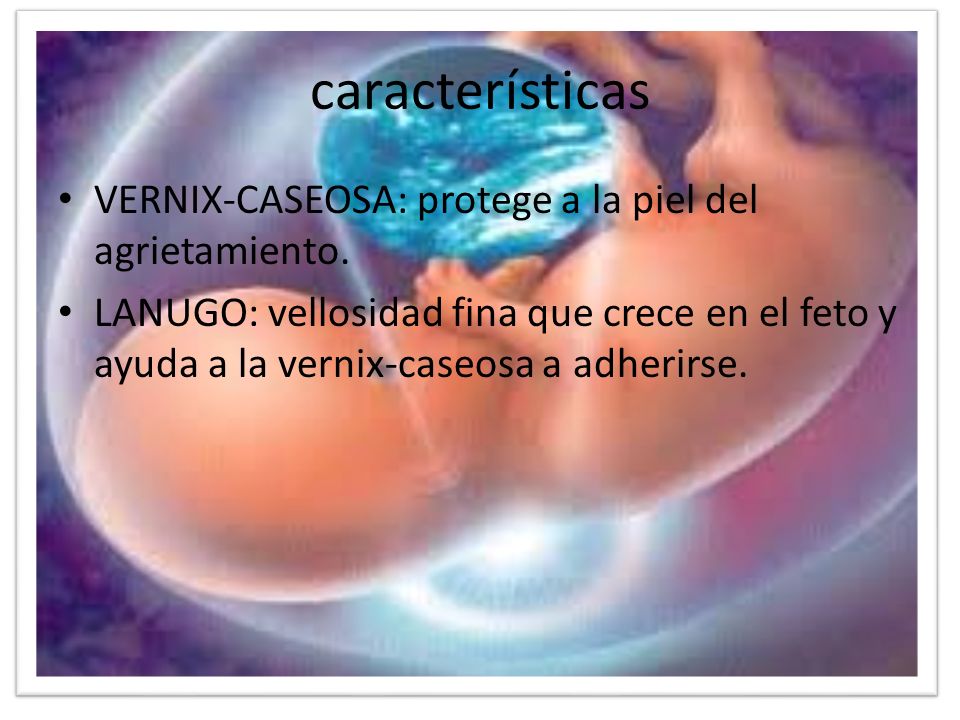 características VERNIX-CASEOSA: protege a la piel del agrietamiento.