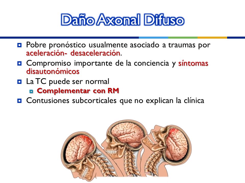 Daño Axonal Difuso Pobre pronóstico usualmente asociado a traumas por aceleración- desaceleración.