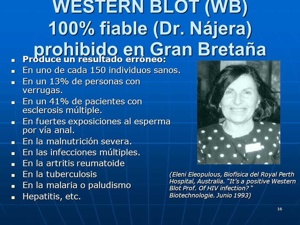 WESTERN BLOT (WB) 100% fiable (Dr. Nájera) prohibido en Gran Bretaña