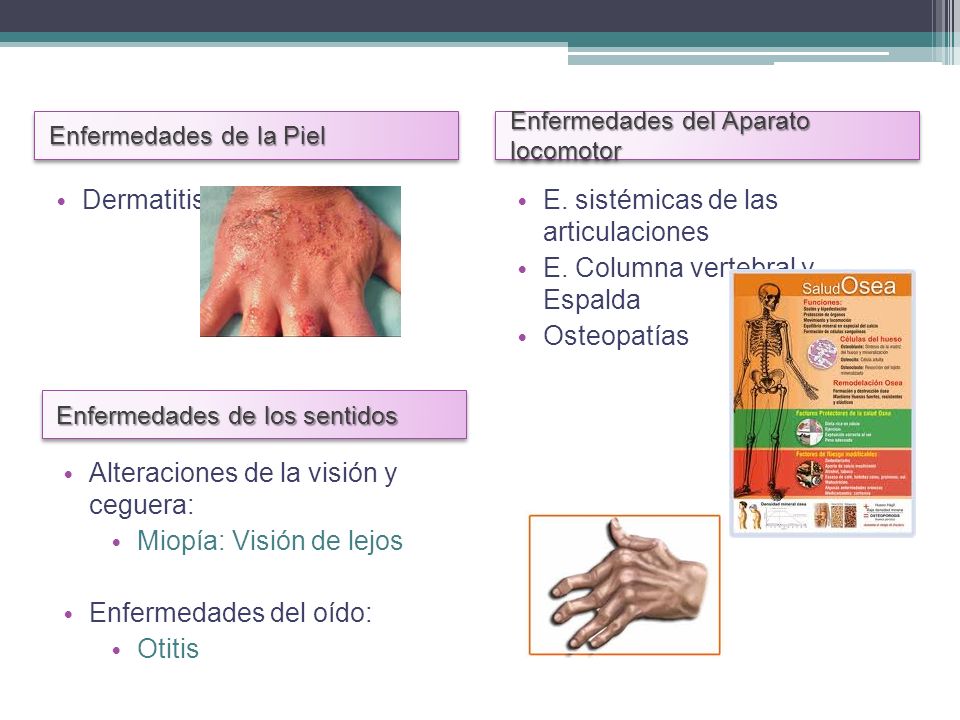 E. sistémicas de las articulaciones E. Columna vertebral y Espalda
