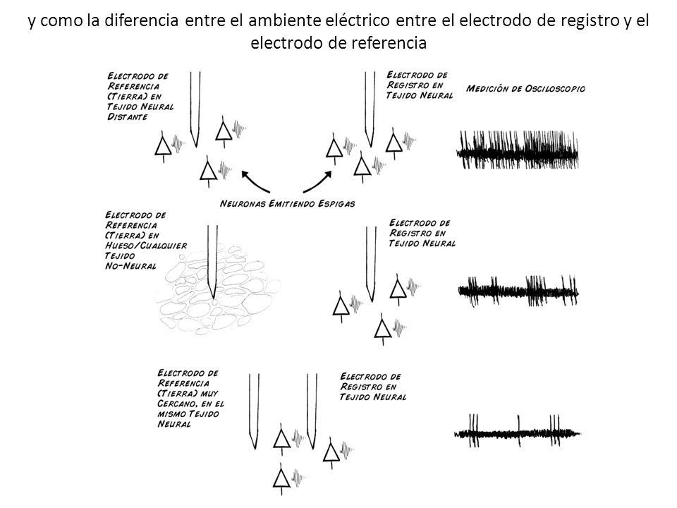 y como la diferencia entre el ambiente eléctrico entre el electrodo de registro y el electrodo de referencia