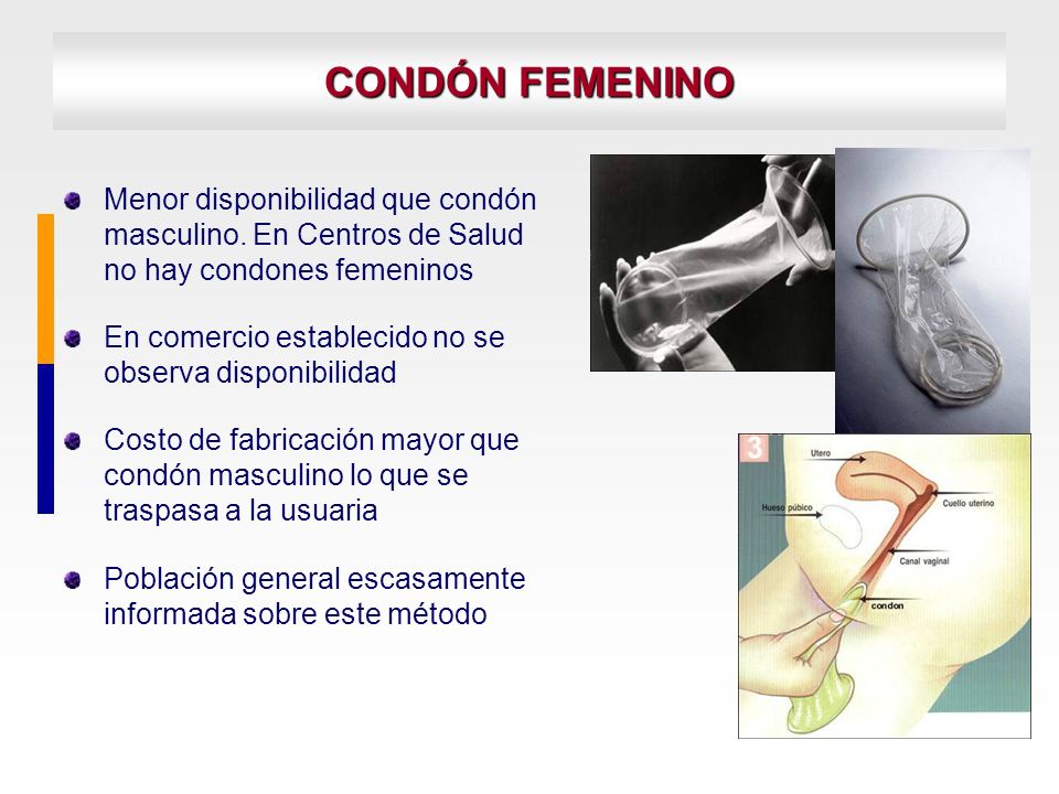 CONDÓN FEMENINO Menor disponibilidad que condón masculino. En Centros de Salud no hay condones femeninos.