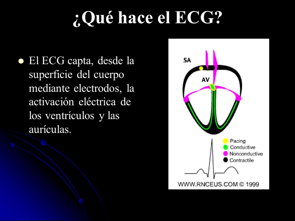 ¿Qué hace el ECG.