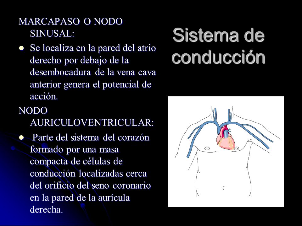 Sistema de conducción MARCAPASO O NODO SINUSAL: