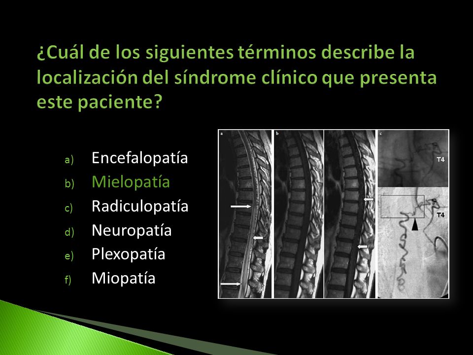 ¿Cuál de los siguientes términos describe la localización del síndrome clínico que presenta este paciente