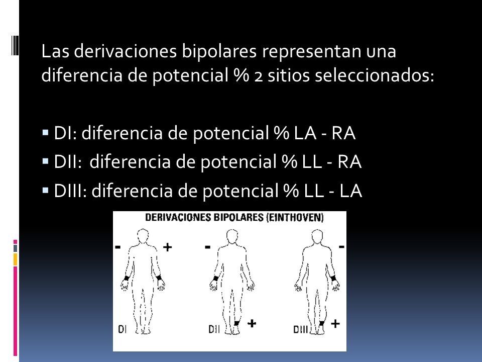Las derivaciones bipolares representan una diferencia de potencial % 2 sitios seleccionados: