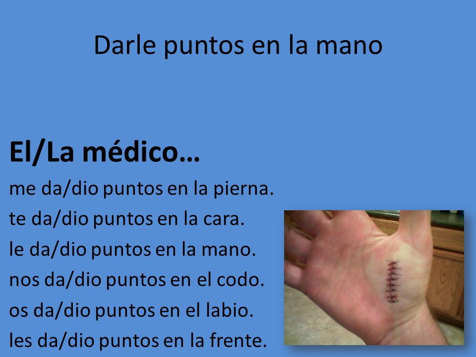 El/La médico… Darle puntos en la mano me da/dio puntos en la pierna.
