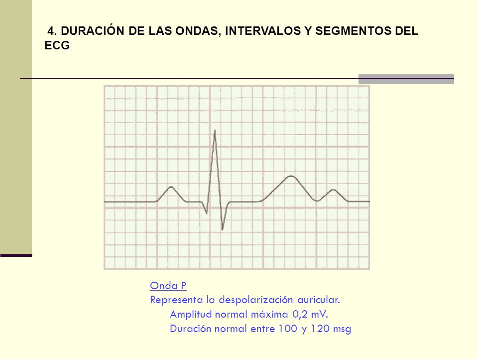 4. DURACIÓN DE LAS ONDAS, INTERVALOS Y SEGMENTOS DEL ECG