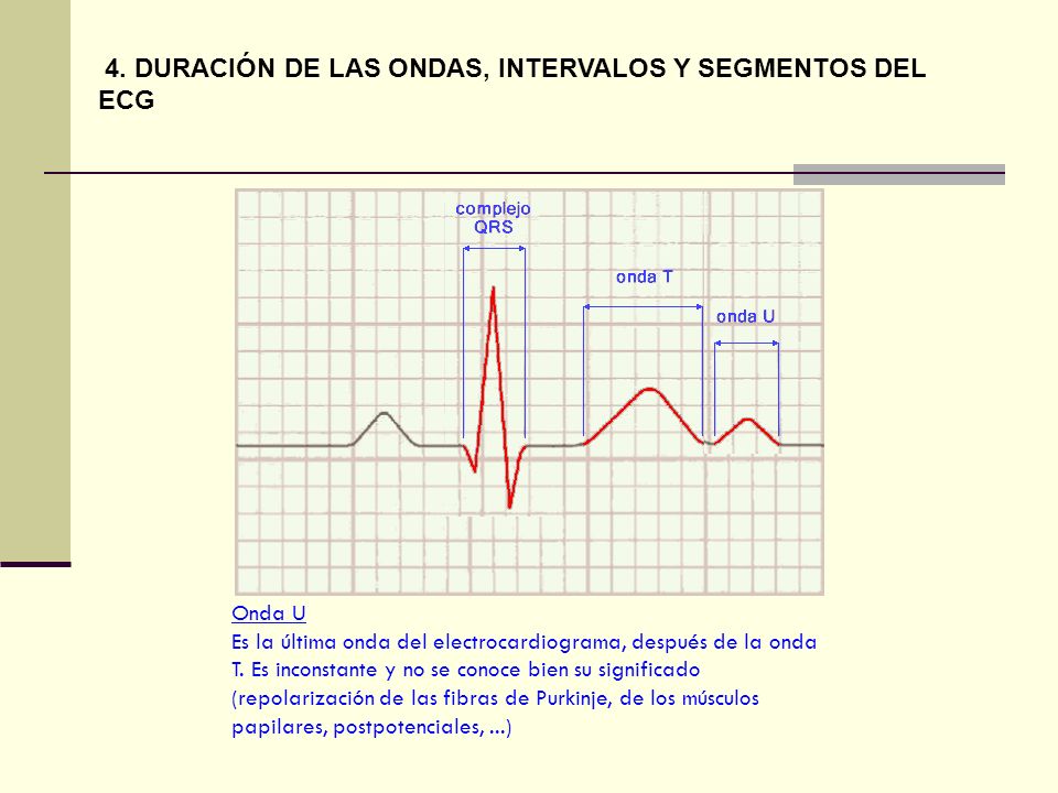 4. DURACIÓN DE LAS ONDAS, INTERVALOS Y SEGMENTOS DEL ECG