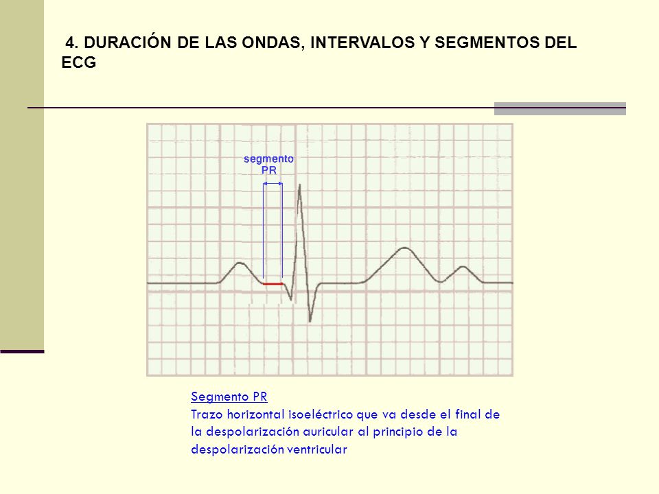 4. DURACIÓN DE LAS ONDAS, INTERVALOS Y SEGMENTOS DEL ECG