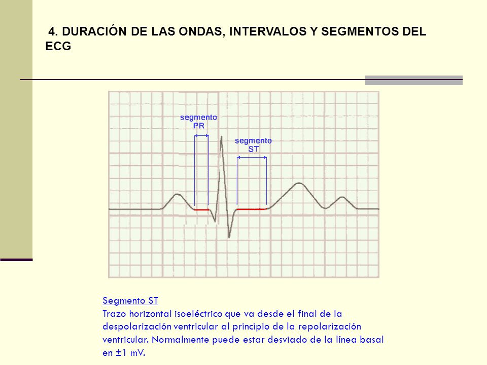 4. DURACIÓN DE LAS ONDAS, INTERVALOS Y SEGMENTOS DEL ECG