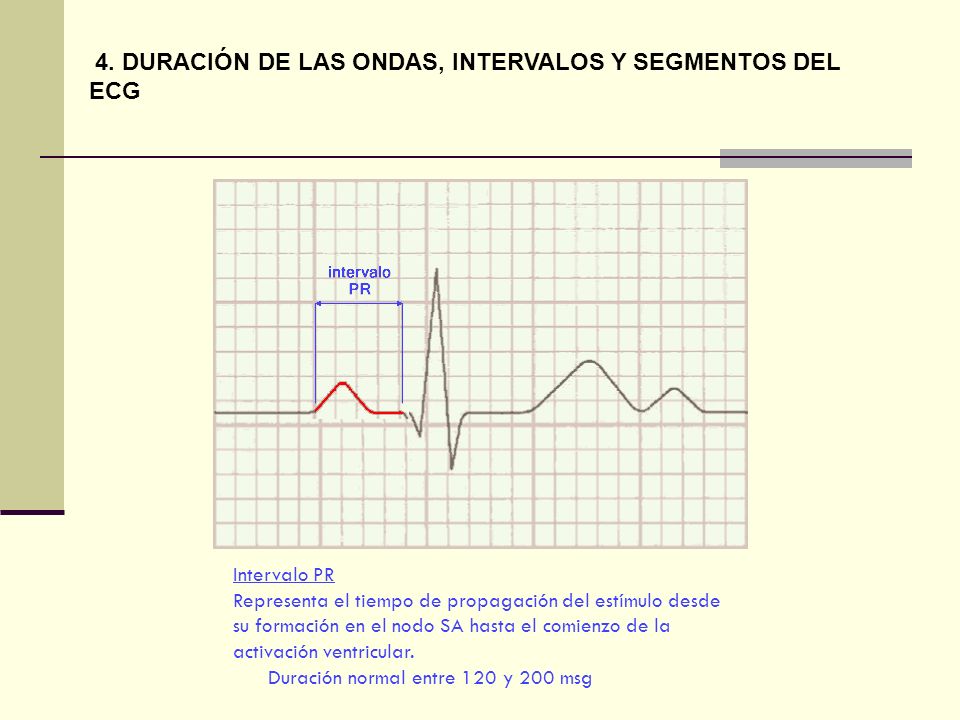 4. DURACIÓN DE LAS ONDAS, INTERVALOS Y SEGMENTOS DEL ECG