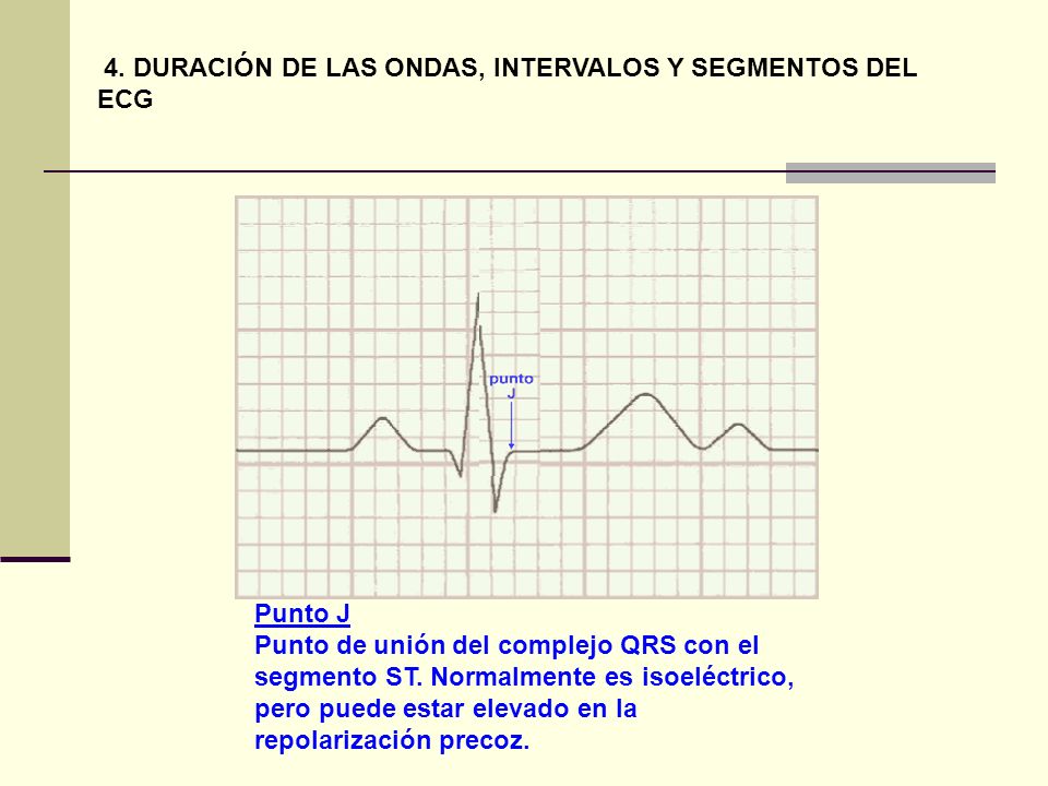 4. DURACIÓN DE LAS ONDAS, INTERVALOS Y SEGMENTOS DEL ECG