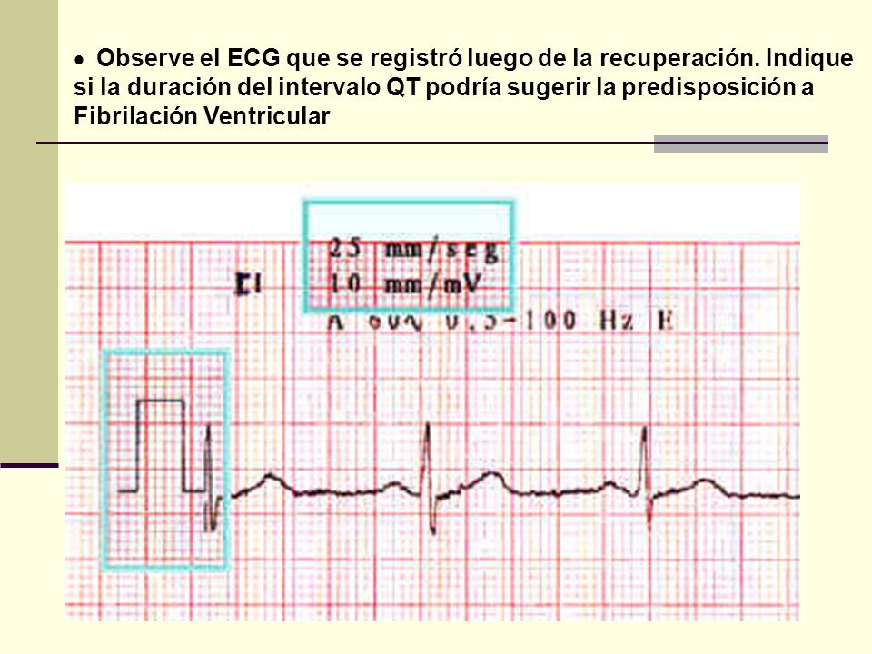 Observe el ECG que se registró luego de la recuperación