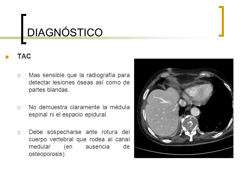 DIAGNÓSTICO TAC. Mas sensible que la radiografía para detectar lesiones óseas así como de partes blandas.