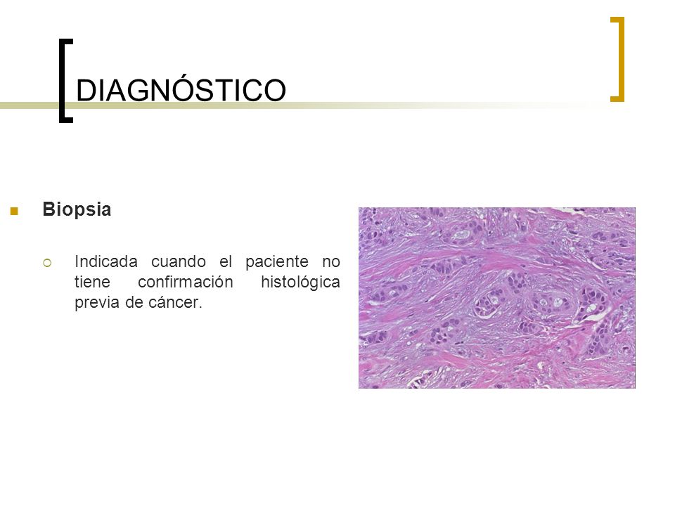 DIAGNÓSTICO Biopsia Indicada cuando el paciente no tiene confirmación histológica previa de cáncer.