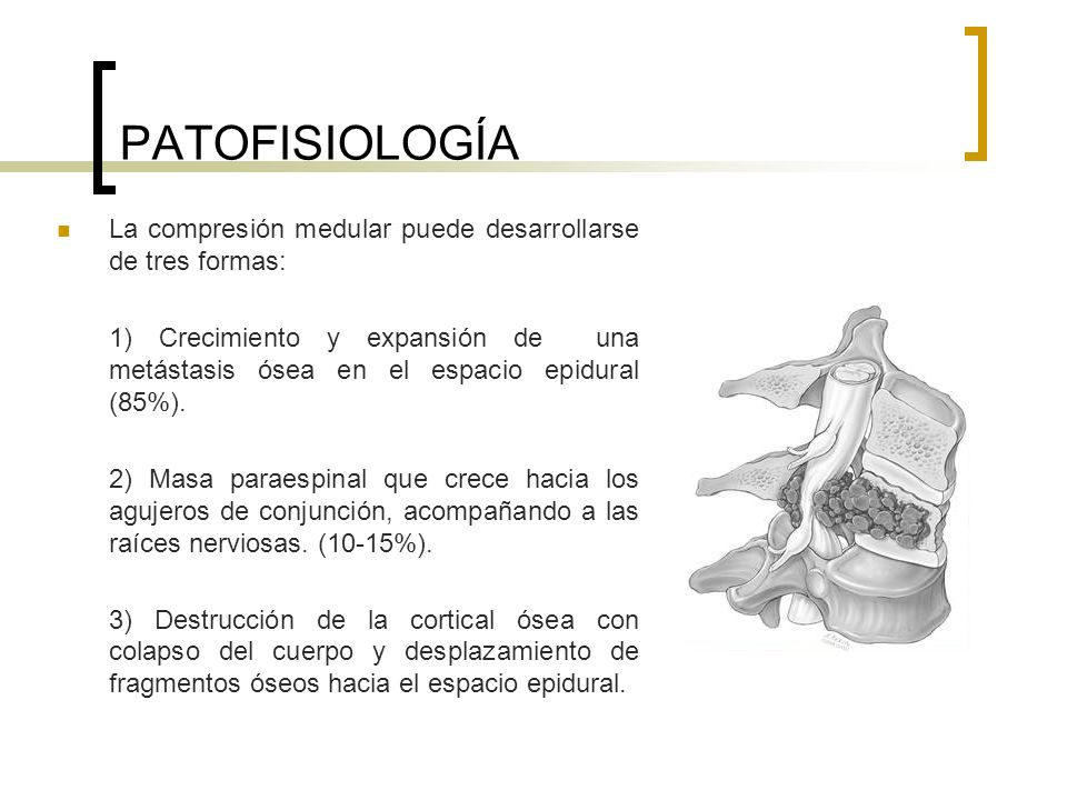 PATOFISIOLOGÍA La compresión medular puede desarrollarse de tres formas: