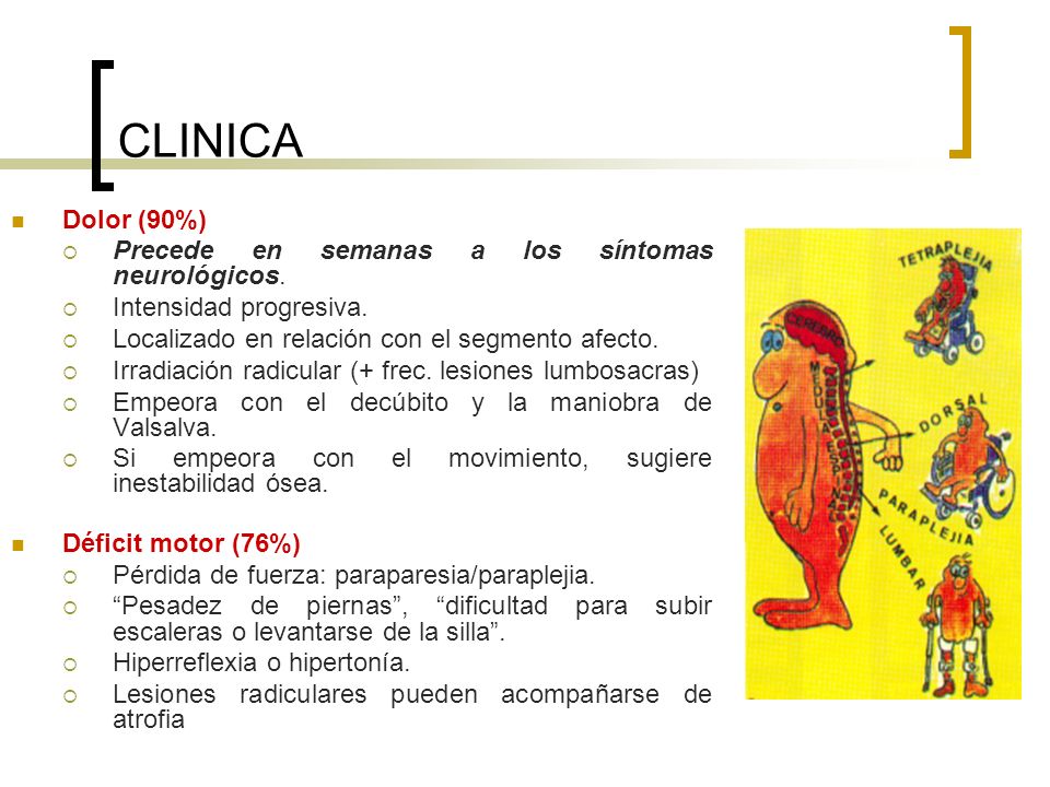CLINICA Dolor (90%) Precede en semanas a los síntomas neurológicos.