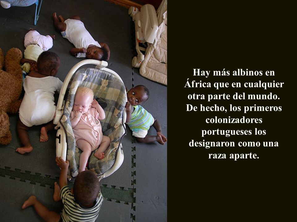 Hay más albinos en África que en cualquier otra parte del mundo