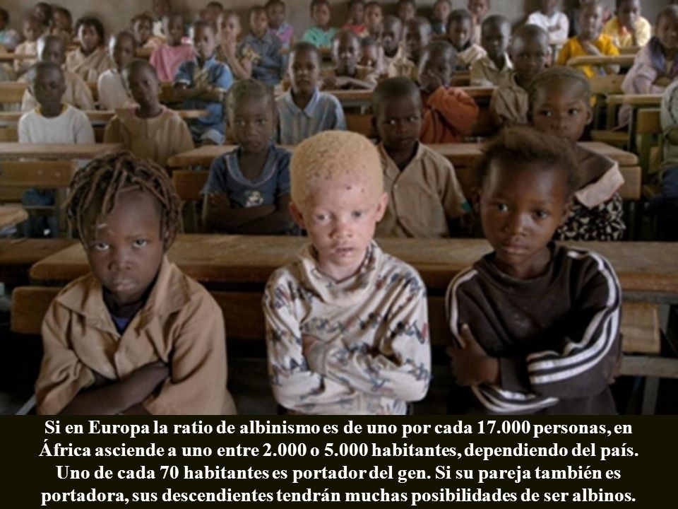 Si en Europa la ratio de albinismo es de uno por cada 17