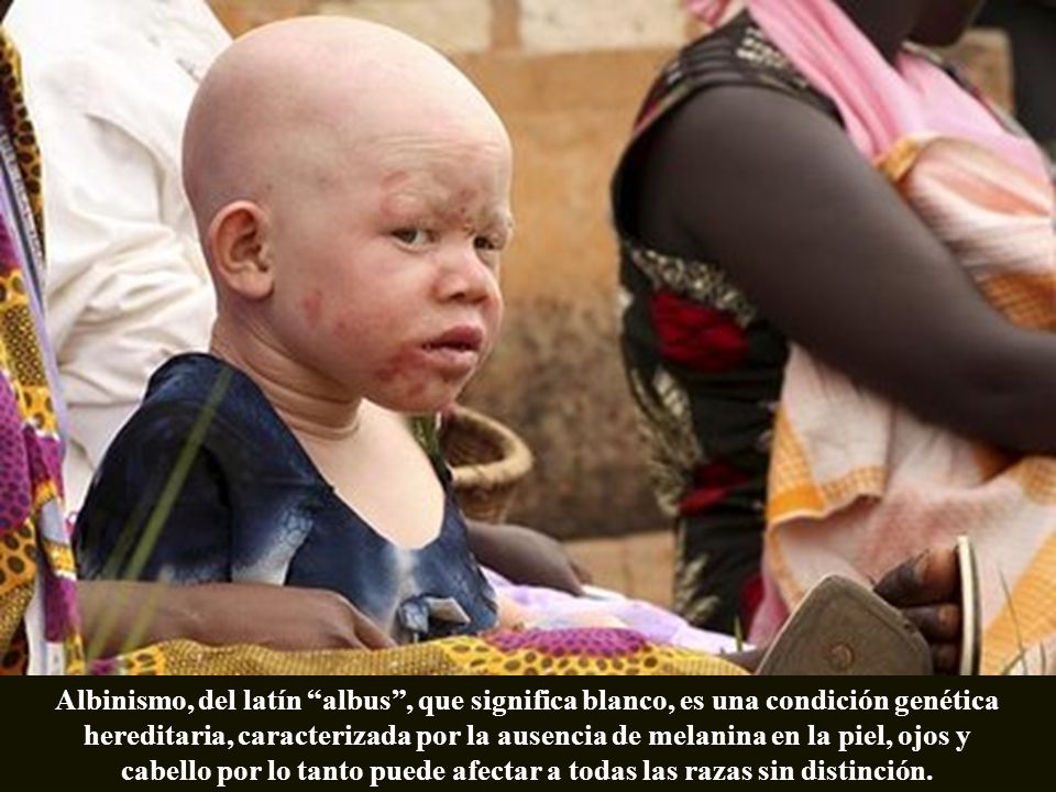 cabello por lo tanto puede afectar a todas las razas sin distinción.
