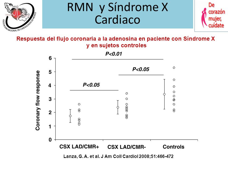Lanza, G. A. et al. J Am Coll Cardiol 2008;51: