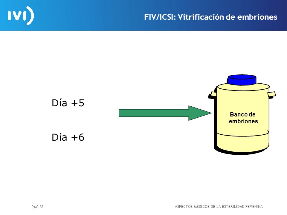 Día +5 Día +6 FIV/ICSI: Vitrificación de embriones Banco de embriones