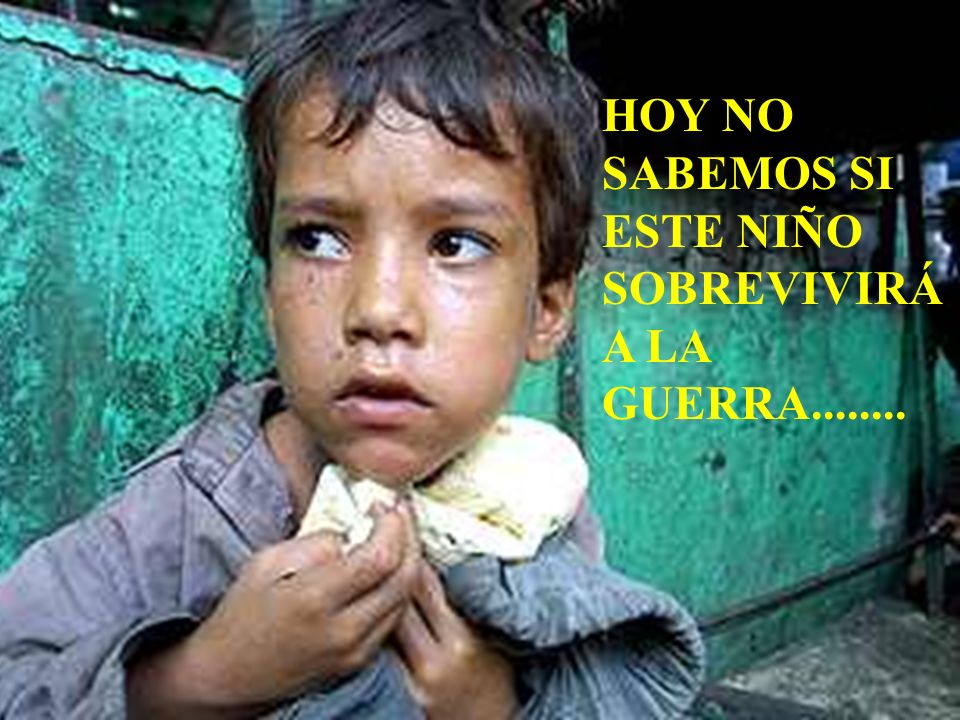 HOY NO SABEMOS SI ESTE NIÑO SOBREVIVIRÁ A LA GUERRA