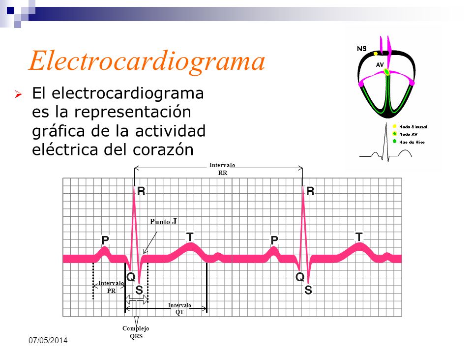 Electrocardiograma El electrocardiograma es la representación gráfica de la actividad eléctrica del corazón.