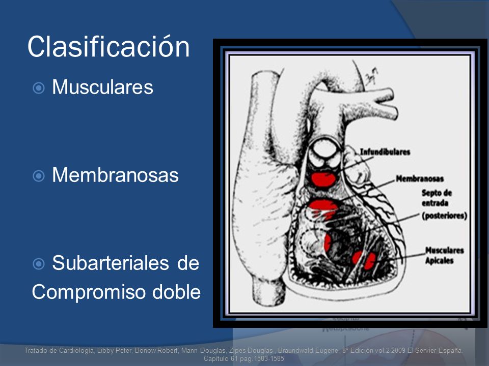 Clasificación Musculares Membranosas Subarteriales de Compromiso doble