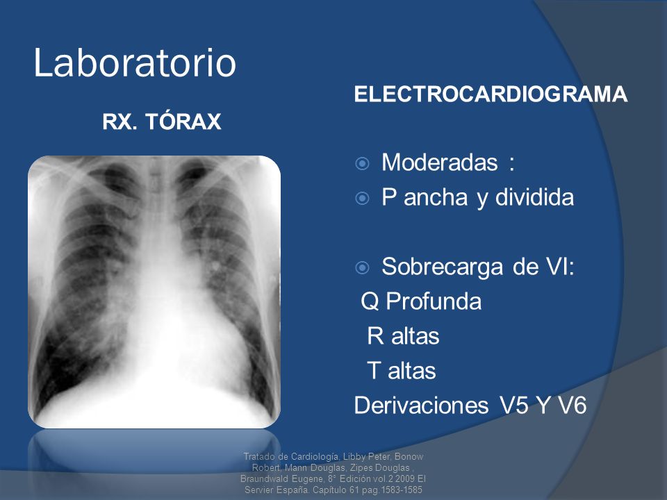 Laboratorio Moderadas : P ancha y dividida Sobrecarga de VI: