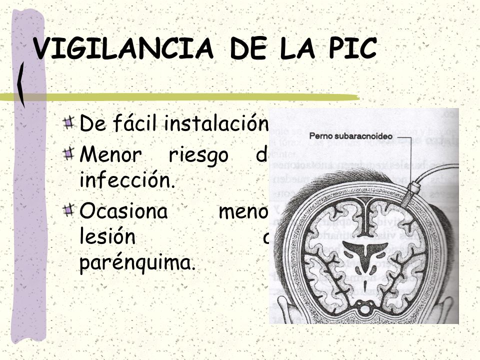VIGILANCIA DE LA PIC De fácil instalación. Menor riesgo de infección.