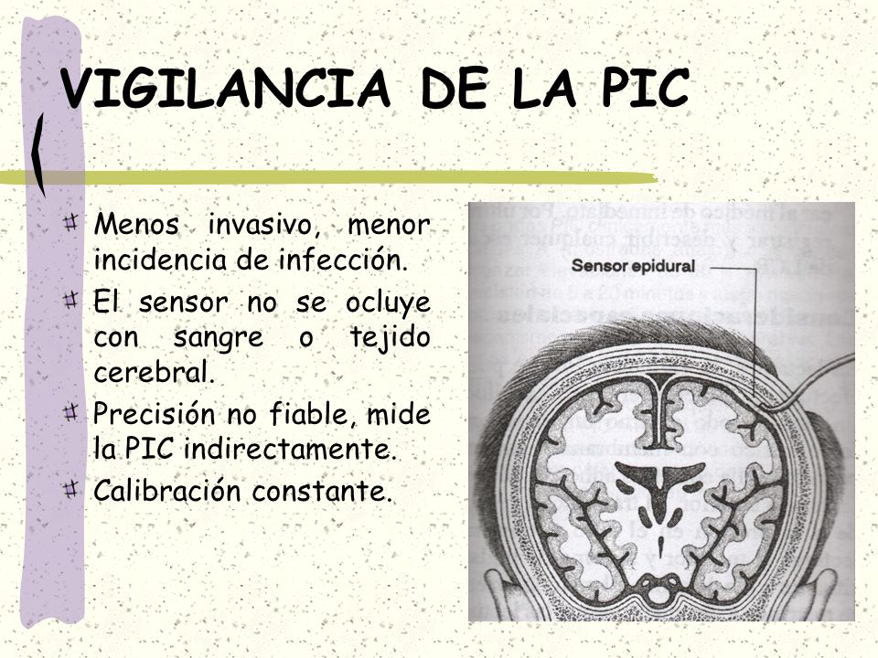 VIGILANCIA DE LA PIC Menos invasivo, menor incidencia de infección.