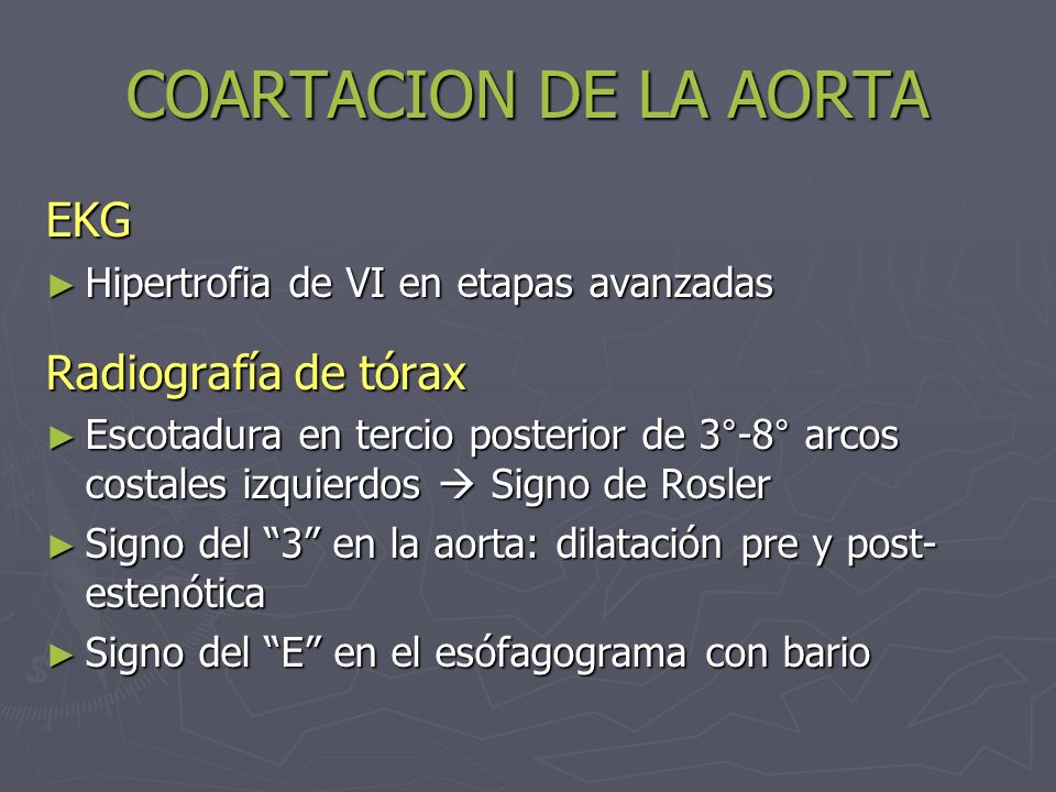 COARTACION DE LA AORTA EKG Radiografía de tórax
