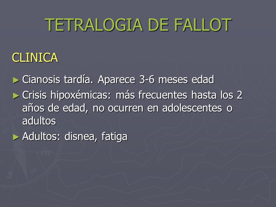 TETRALOGIA DE FALLOT CLINICA Cianosis tardía. Aparece 3-6 meses edad