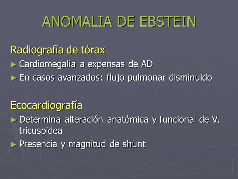 ANOMALIA DE EBSTEIN Radiografía de tórax Ecocardiografía
