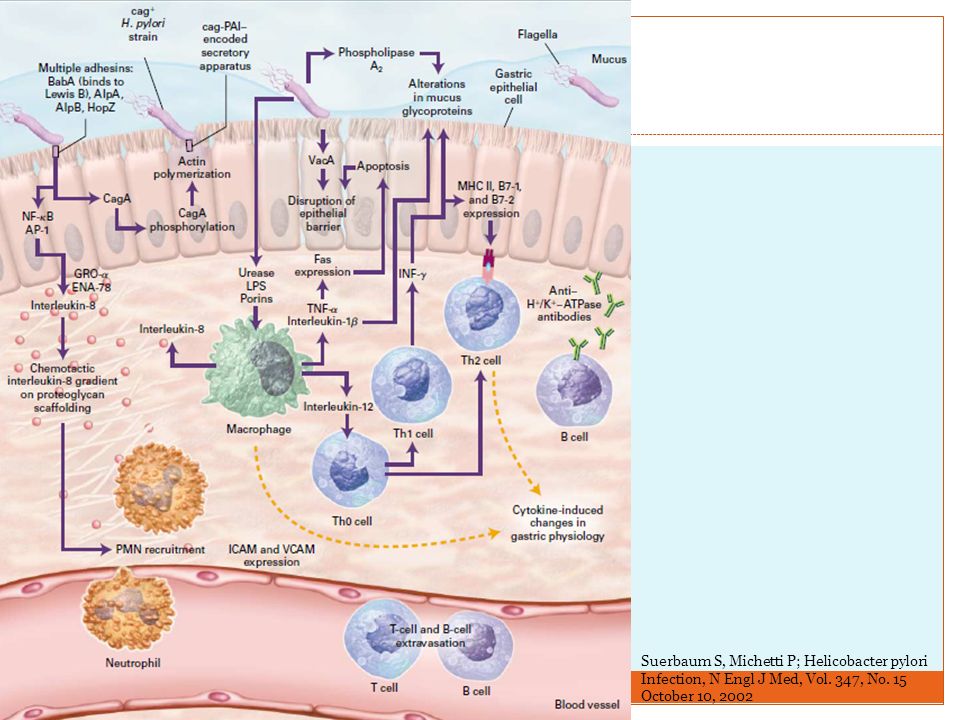 Suerbaum S, Michetti P; Helicobacter pylori Infection, N Engl J Med, Vol.